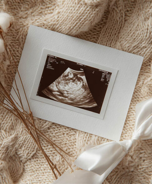 Tiny newborn nestled in a knitted layer, Melbourne newborn & baby studio