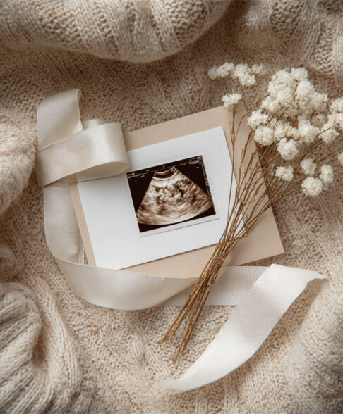 Newborn milestone portrait with delicate props, Melbourne newborn photography